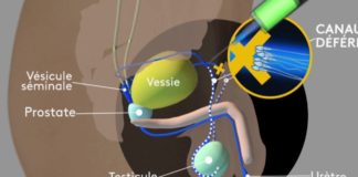 Contraception : les hommes enfin ! Sante-Contraception-les-hommes-enfin-