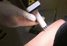 Laser et cicatrices Sante Laser et cicatrices