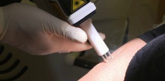 Laser et cicatrices Sante Laser et cicatrices