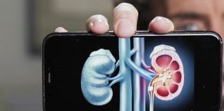 Tout sur la colique néphrétique Sante Tout sur la colique nephretique