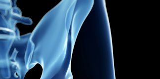 Fracture du col du fémur : elle peut bouleverser une vie Fracture du col du femur elle peut bouleverser une vie