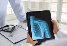 Comment soigner une fracture de l'épaule ? Comment soigner une fracture de l039epaule