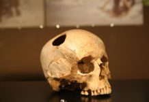 Trépanation : Homo sapiens pratiquait-il des opérations chirurgicales complexes ? Trepanation Homo sapiens pratiquait il des operations chirurgicales complexes