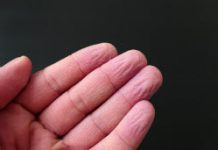 Bain, piscine… : pourquoi vos doigts deviennent fripés ?