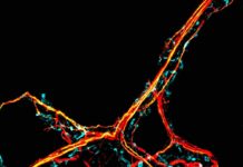 Les neurones des caresses pour limiter l'inflammation Les-neurones-des-caresses-pour-limiter-l039inflammation
