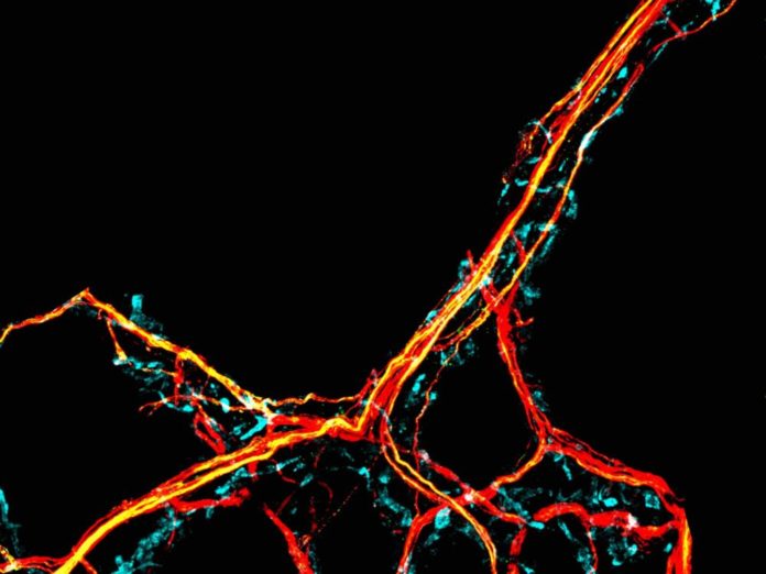 Les-neurones-des-caresses-pour-limiter-l039inflammation