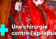 Épilepsie : un implant pour limiter les crises – Epilepsie-un-implant-pour-limiter-les-crises-