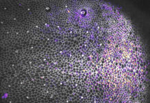 La mort cellulaire, garante de l’intégrité des tissus La-mort-cellulaire-garante-de-lintegrite-des-tissus