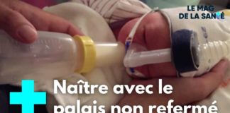 La séquence Pierre Robin La-sequence-Pierre-Robin-