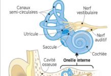 Comment se libérer des vertiges ? REPORTAGE -Comment-se-liberer-des-vertiges-