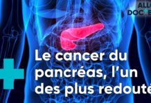 Cancer du pancréas, quels progrès ? Cancer-du-pancreas-quels-progres-