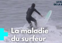 Exostose : des excroissances osseuses Exostose-des-excroissances-osseuses-