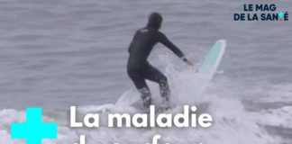 Exostose : des excroissances osseuses Exostose-des-excroissances-osseuses-