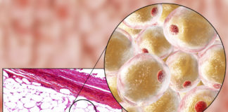 La graisse beige serait “indispensable” pour protéger le cerveau de la démence La-graisse-beige-serait-indispensable-pour-proteger-le-cerveau-de-la-demence