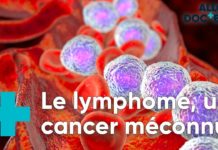 Lymphome : quelle prise en charge ? Lymphome-quelle-prise-en-charge-