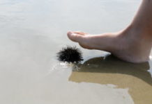 Oursins, méduses, vives : comment réagir face à une piqûre ? Oursins-meduses-vives-comment-reagir-face-a-une-piqure-