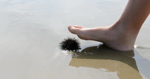 Oursins, méduses, vives : comment réagir face à une piqûre ? Oursins-meduses-vives-comment-reagir-face-a-une-piqure-