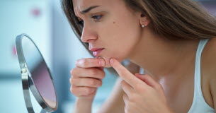 Acné sévère : quelles solutions ? Quelles-solutions-contre-lacne-severe-