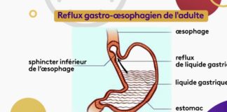 La question du reflux Sante-La-question-du-reflux