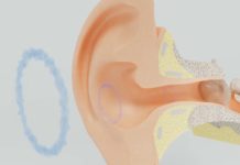 Ostopongiose Sante-Ostopongiose