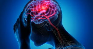 Un traitement vital pour oxygéner le cerveau pendant un AVC AVC-quel-est-ce-traitement-vital-pour-oxygener-le-cerveau-