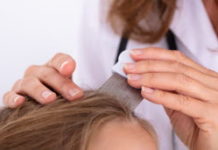 Poux : comment savoir si votre enfant en est victime ? Comment-savoir-si-votre-enfant-a-des-poux-