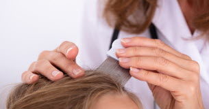 Poux : comment savoir si votre enfant en est victime ? Comment-savoir-si-votre-enfant-a-des-poux-