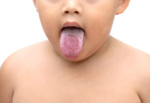 Muguet chez bébé : il faut rapidement le traiter Le-muguet-mycose-buccal-chez-bebe-a-traiter-rapidement