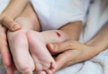 L’angiome et l’hémangiome du bébé Angiome-et-hemangiome-quelle-est-cette-tache-sur-mon-bebe-