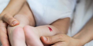 L’angiome et l’hémangiome du bébé Angiome-et-hemangiome-quelle-est-cette-tache-sur-mon-bebe-