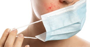 Comment limiter les dégâts du masque sur la peau Covid-19 -Masques-comment-limiter-les-degats-sur-votre-peau