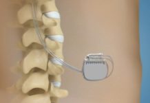 Un boîtier contre la douleur Sante-Un-boitier-contre-la-douleur