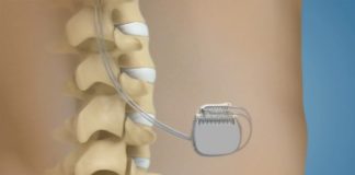 Un boîtier contre la douleur Sante-Un-boitier-contre-la-douleur