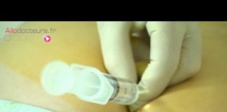 Des infiltrations pour atténuer la douleur de la sciatique Sciatique-des-infiltrations-pour-attenuer-la-douleur-Allo-Docteurs