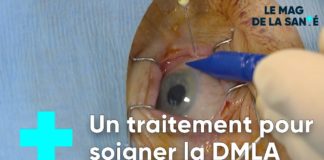 Prévenir la DMLA grâce à des injections Des-injections-pour-prevenir-la-DMLA-