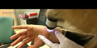 Diagnostiquer la gale Diagnostiquer-la-gale-Allo-Docteurs