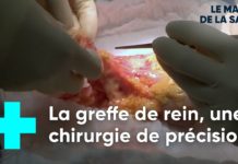 Comment fonctionne une greffe de rein ? Greffe-de-rein-comment-ca-marche-