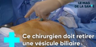 Quand il faut retirer la vésicule biliaire : la cholécystectomie La-cholecystectomie-quand-il-faut-retirer-la-vesicule-biliaire-