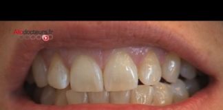 Mal de dents : les remèdes de grand-mères Les-remedes-de-grand-meres-contre-le-mal-de-dents-