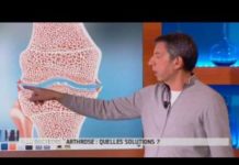 C’est quoi, l’arthrose ? Quest-ce-que-larthrose-Allo-Docteurs