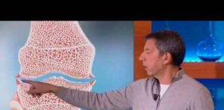 C’est quoi, l’arthrose ? Quest-ce-que-larthrose-Allo-Docteurs
