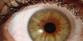 Soleil, attention les yeux ! Sante-Soleil-attention-les-yeux-