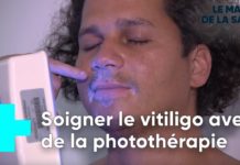 Un traitement prometteur pour lutter contre le vitiligo et repigmenter la peau Vitiligo-un-traitement-prometteur-pour-repigmenter-la-peau-