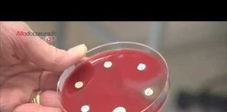 La chasse à l’helicobacter pylori, cause de certains maux d’estomac Maux-destomac-la-chasse-a-lHelicobacter-pylori-Allo-Docteurs