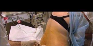 Quand faut-il réaliser une ponction lombaire ? Urgences-quand-faut-il-faire-une-ponction-lombaire-