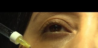 L’acide hyaluronique pour combler les cernes Combler-les-cernes-grace-a-lacide-hyaluronique-Allo-Docteurs