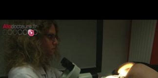 Comment dépister et traiter les lésions précancéreuses, les condylomes ? Condylomes-depister-et-traiter-les-lesions-precancereuses-Le