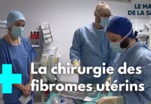 L’opération du fibrome utérin Fibrome-uterin-quand-il-faut-operer-