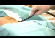 La technique de Malone contre la constipation sévère Constipation-severe-la-technique-de-Malone-Allo-Docteurs