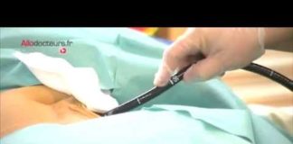 La technique de Malone contre la constipation sévère Constipation-severe-la-technique-de-Malone-Allo-Docteurs